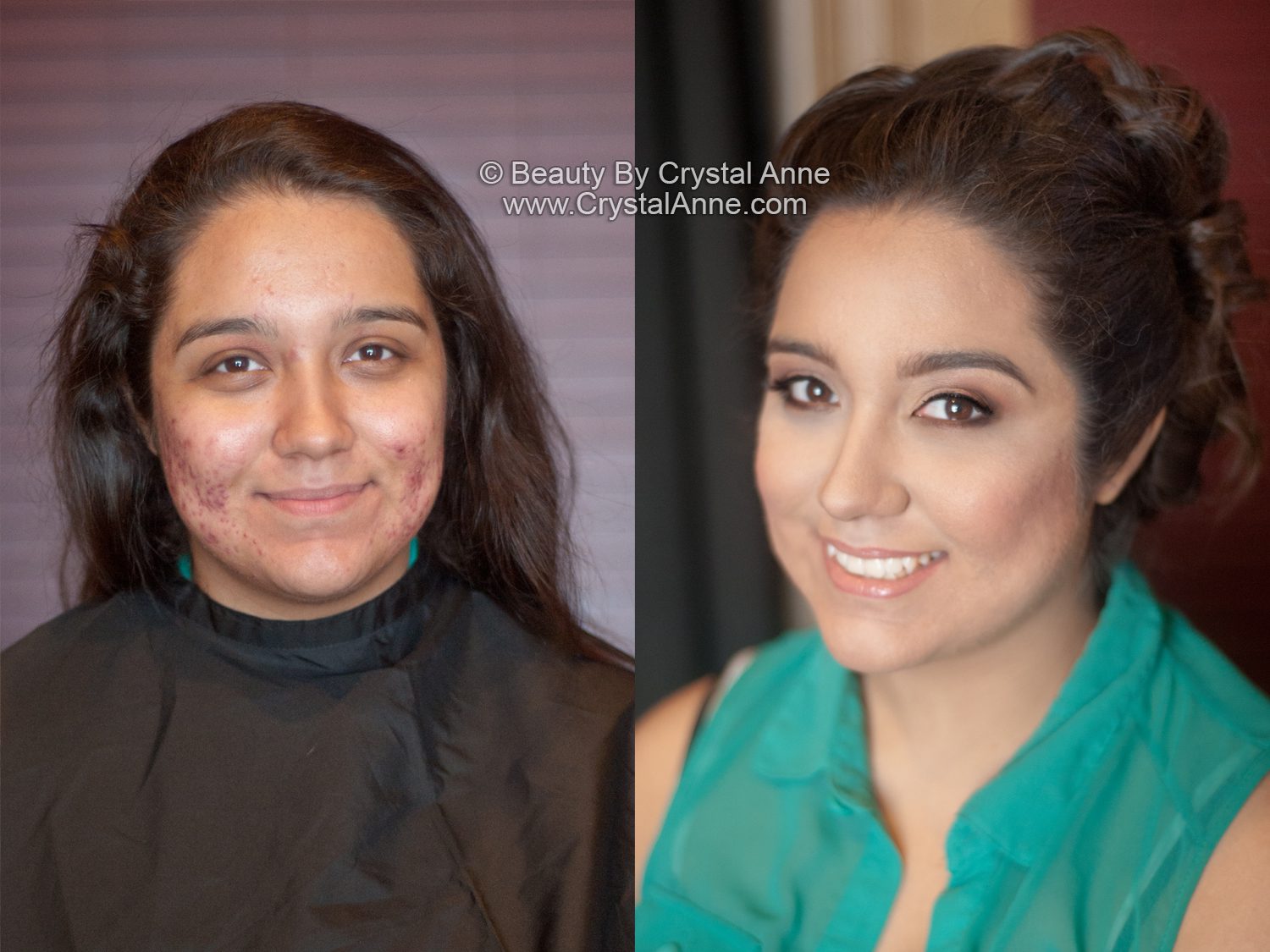 Airbrush Makeup Before And After Acne Mugeek Vidalondon