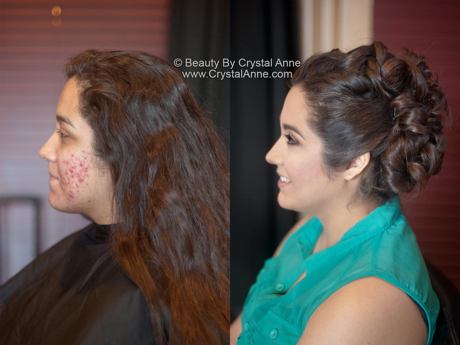 Airbrush Makeup For Acne - Airbrush Makeup For Acne E Skin Airbrush Makeup For Acne - Airbrush Makeup For Acne E Skin